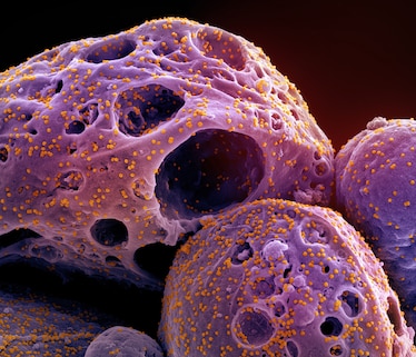 Colorized scanning electron micrograph of a cell infected with the Omicron strain of SARS-CoV-2 virus particles