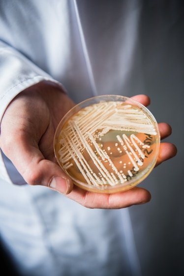 A petri dish is held out to show the streaks of white candida auris yeast growing across the surface.